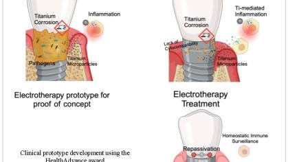 Image for HealthAdvance project titled Electrotherapy (Titanium Implant Repassivation Device)