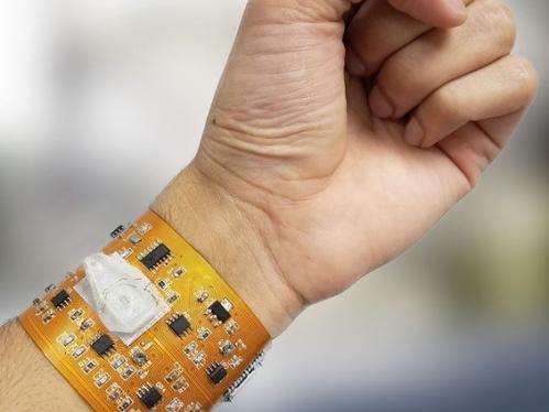 SmartWristband image