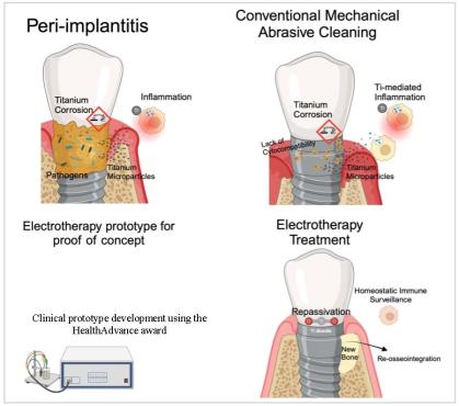 Image for HealthAdvance project titled Electrotherapy (Titanium Implant Repassivation Device)